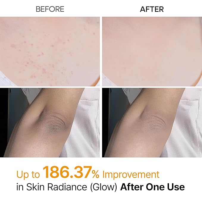 Dr.Melaxin Peel Shot Body Keratin Care Kojic Acid Turmeric Spray with AHA & PHA 200 ml