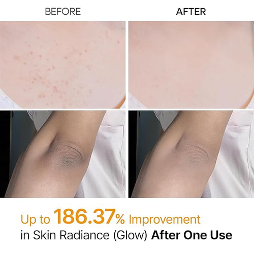 Dr.Melaxin Peel Shot Body Keratin Care Kojic Acid Turmeric Spray with AHA & PHA 200 ml