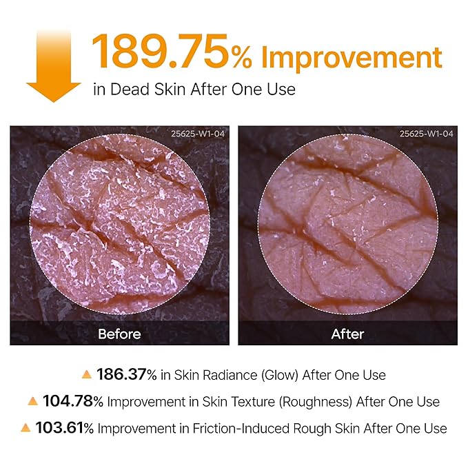 Dr.Melaxin Peel Shot Body Keratin Care Kojic Acid Turmeric Spray with AHA & PHA 200 ml